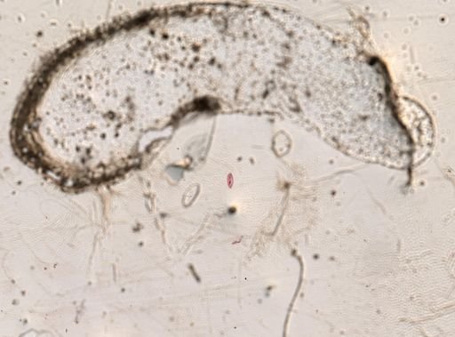 Paramecium