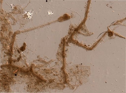 Bryozoa