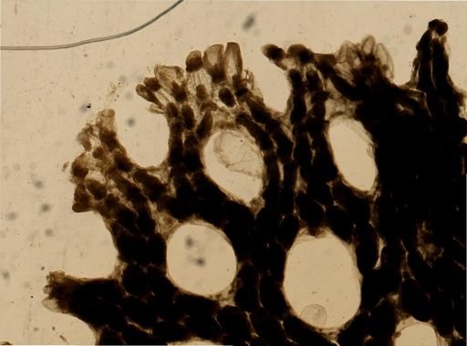 Bryozoa