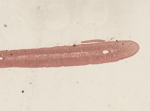 Taenia taeniaeformis