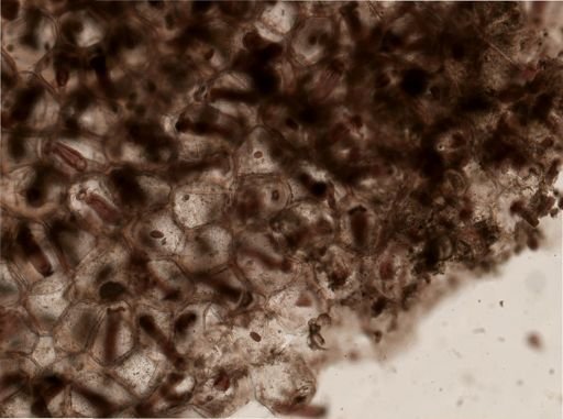 Pedicellina