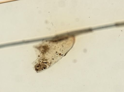 Pediculus humanus