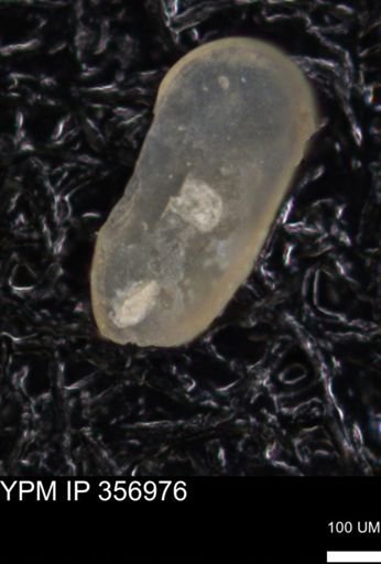 undet. Ostracoda