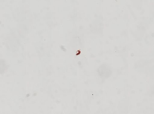 Trematoda