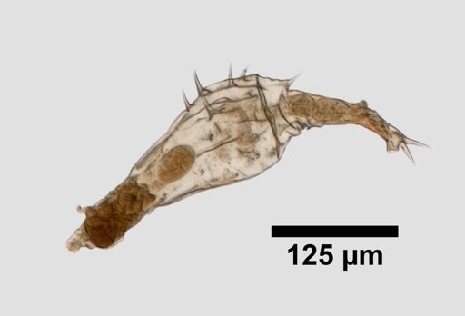 Dissotrocha aculeata