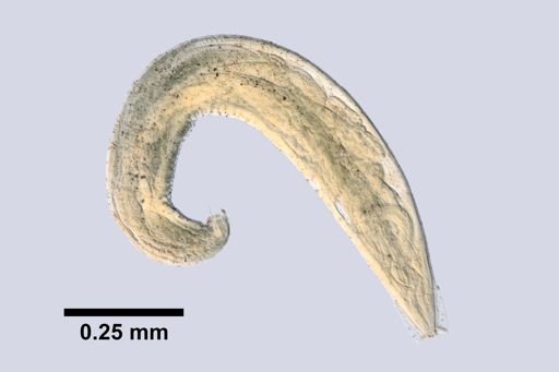 Enterobius vermicularis