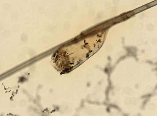 Pediculus humanus