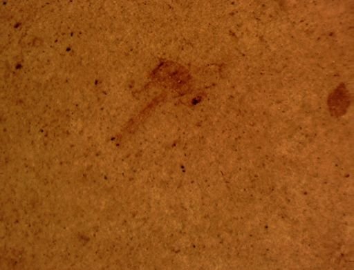 undet. Hexapoda