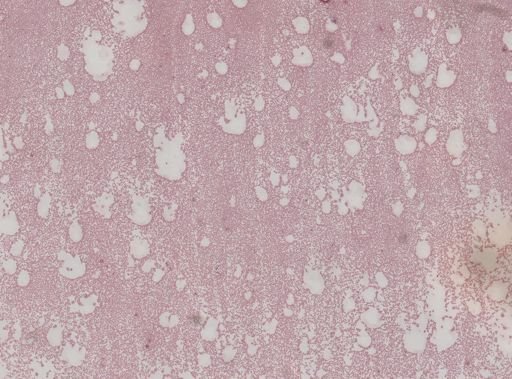 Trypanosoma?