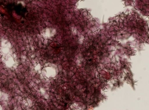 Antho lithophoenix