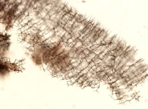 Toxadocia sp.