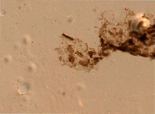 Bryozoa