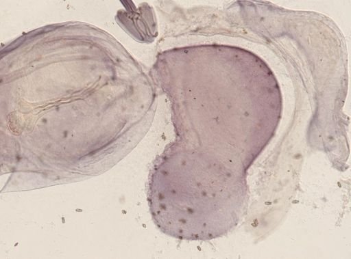 Otobothrium cysticum