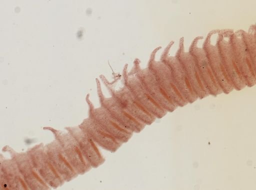 Hymenolepis villosa
