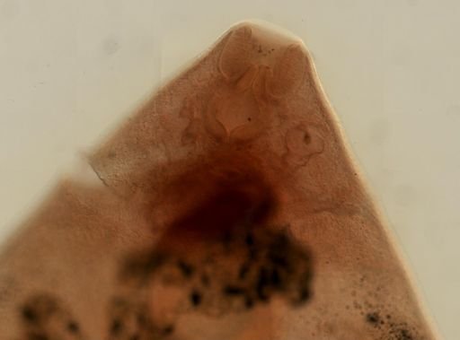 Fasciola hepatica
