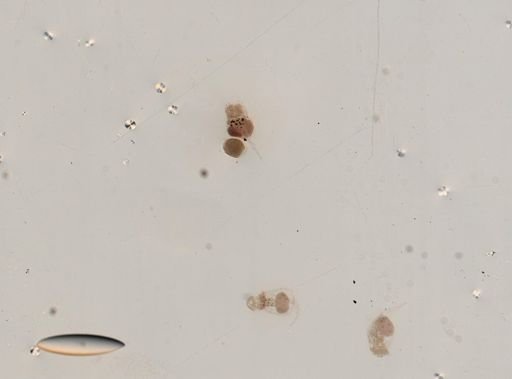 Brachionus urceolaris
