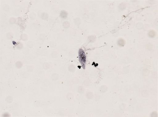Paramecium