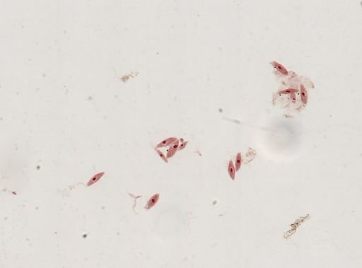 Paramecium