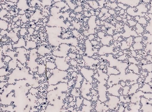 Trypanosoma tritonis