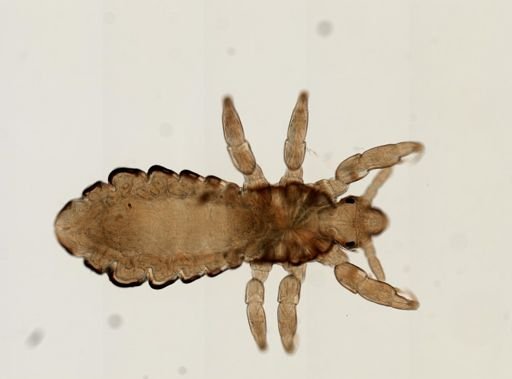 Pediculus humanus