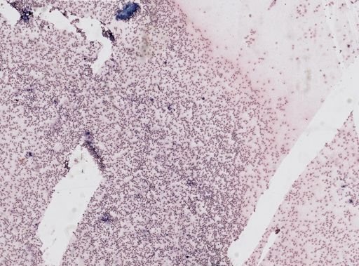 Trypanosoma