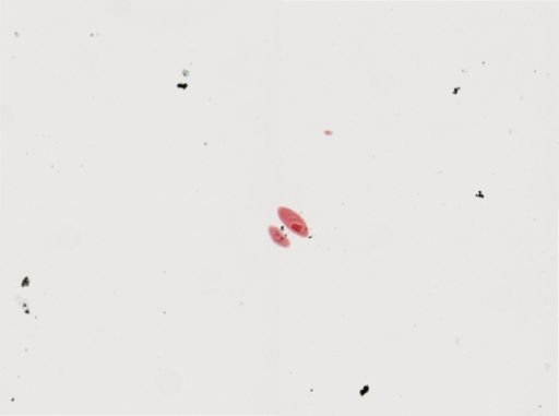 Paramecium calkinsi