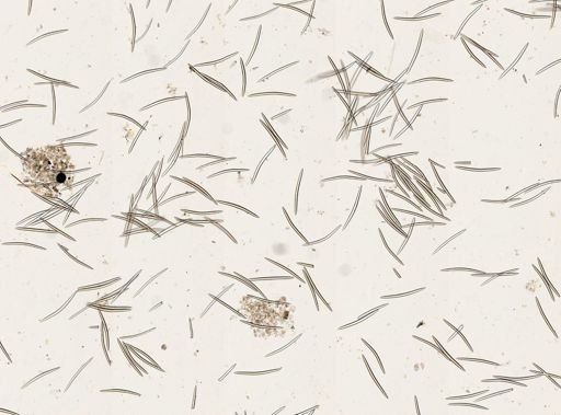 Spongilla fragilis