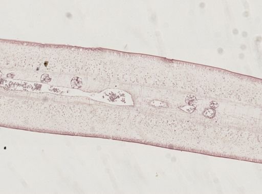 Taenia saginata
