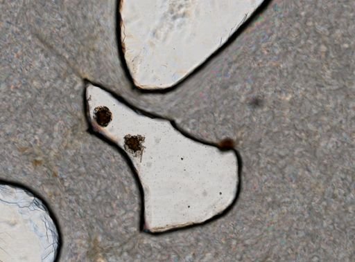 Brachionus plicatilis
