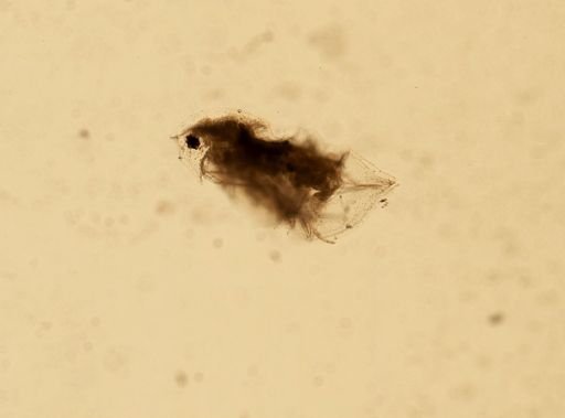 Daphnia pulex
