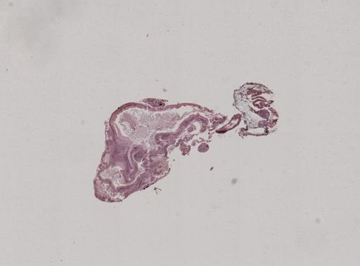 Crepidula convexa