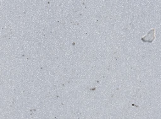 Plasmodium vivax