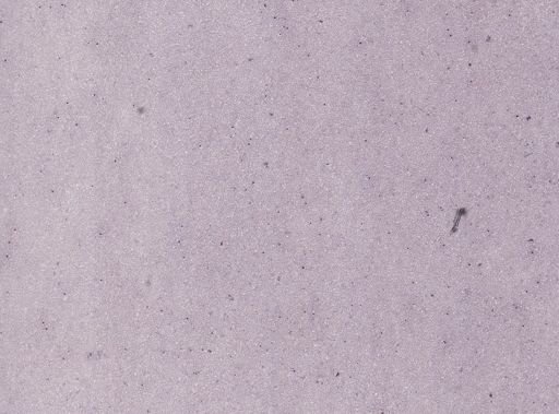 Trypanosoma lewisi