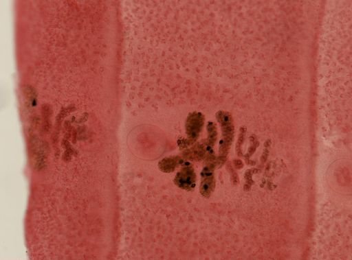 Diphyllobothrium latum