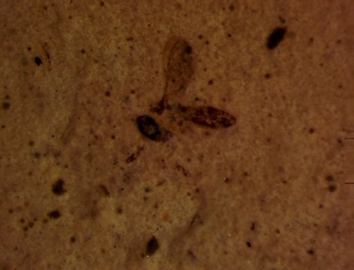 undet. Diptera