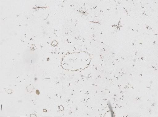Leucosolenia