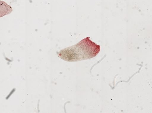 Dendrocometes paradoxus