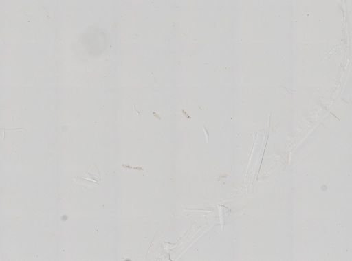 Paramecium