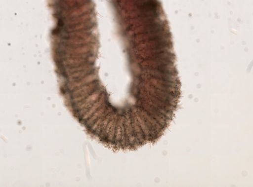 Scypha?