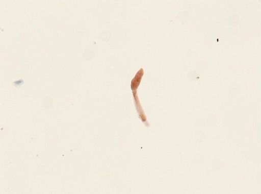 Schistosoma mansoni