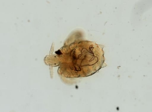 Pthirus pubis