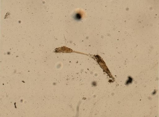 Savignyella lafontii