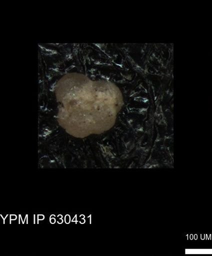 undet. Rugoglobigerinidae