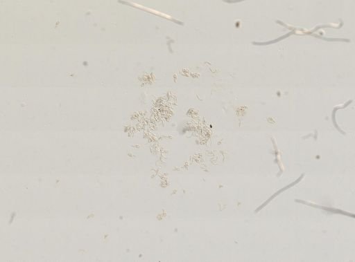 Amnicola orbiculata