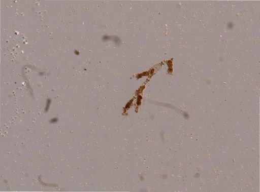 Catenicellidae