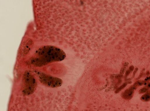 Diphyllobothrium latum