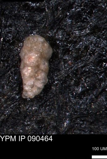 Verneuilina canadensis