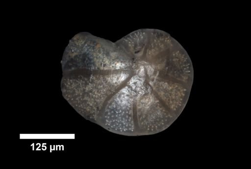 Cibicides primulus