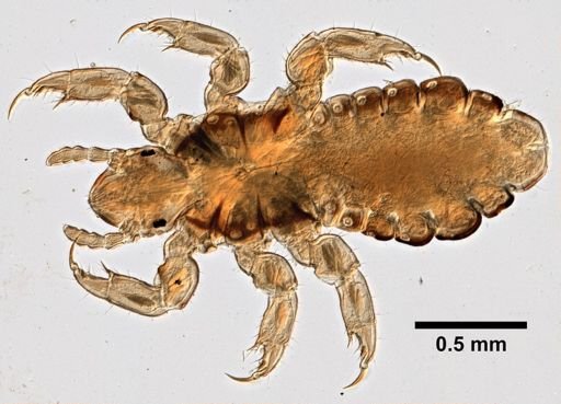 Pediculus humanus