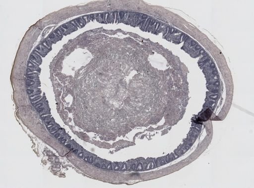 Eimeria meleagrimitis